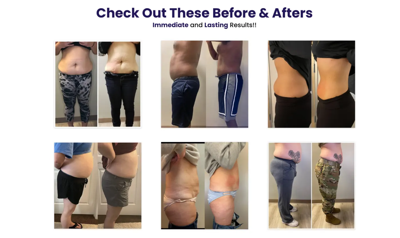 Med Spa (CryoSlimming) snapshot screenshot